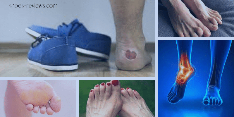 Can Tight Shoes Cause Foot Pain (1)